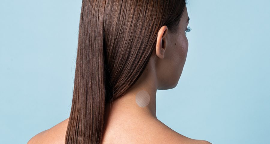 Anti Hair Loss Iontophoretic Patch