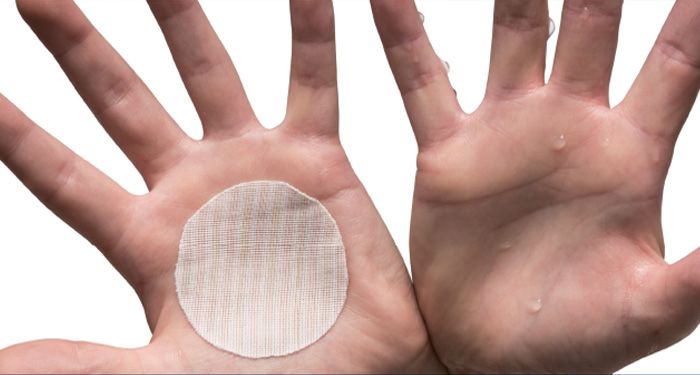 Hyperhidrosis Iontophoretic Patch