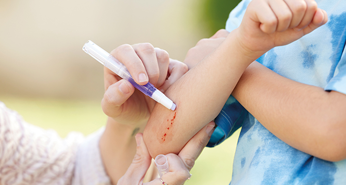 Pen for Small Wounds and Cuts