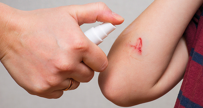 Wound Spray